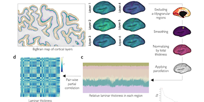 BigBrain: An Ultrahigh-Resolution 3D Human Brain Model